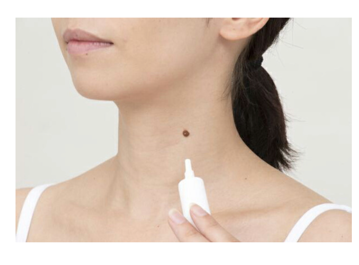 Tsubuporon Night Patch (Millet Seed Remover)